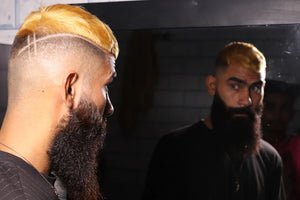 Lifestyle Factors That Contribute to Hair Loss